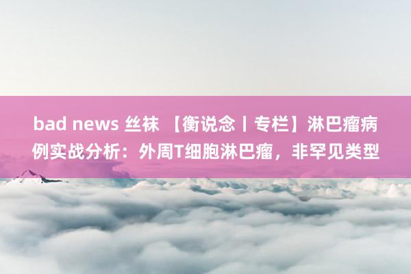 bad news 丝袜 【衡说念丨专栏】淋巴瘤病例实战分析：外周T细胞淋巴瘤，非罕见类型